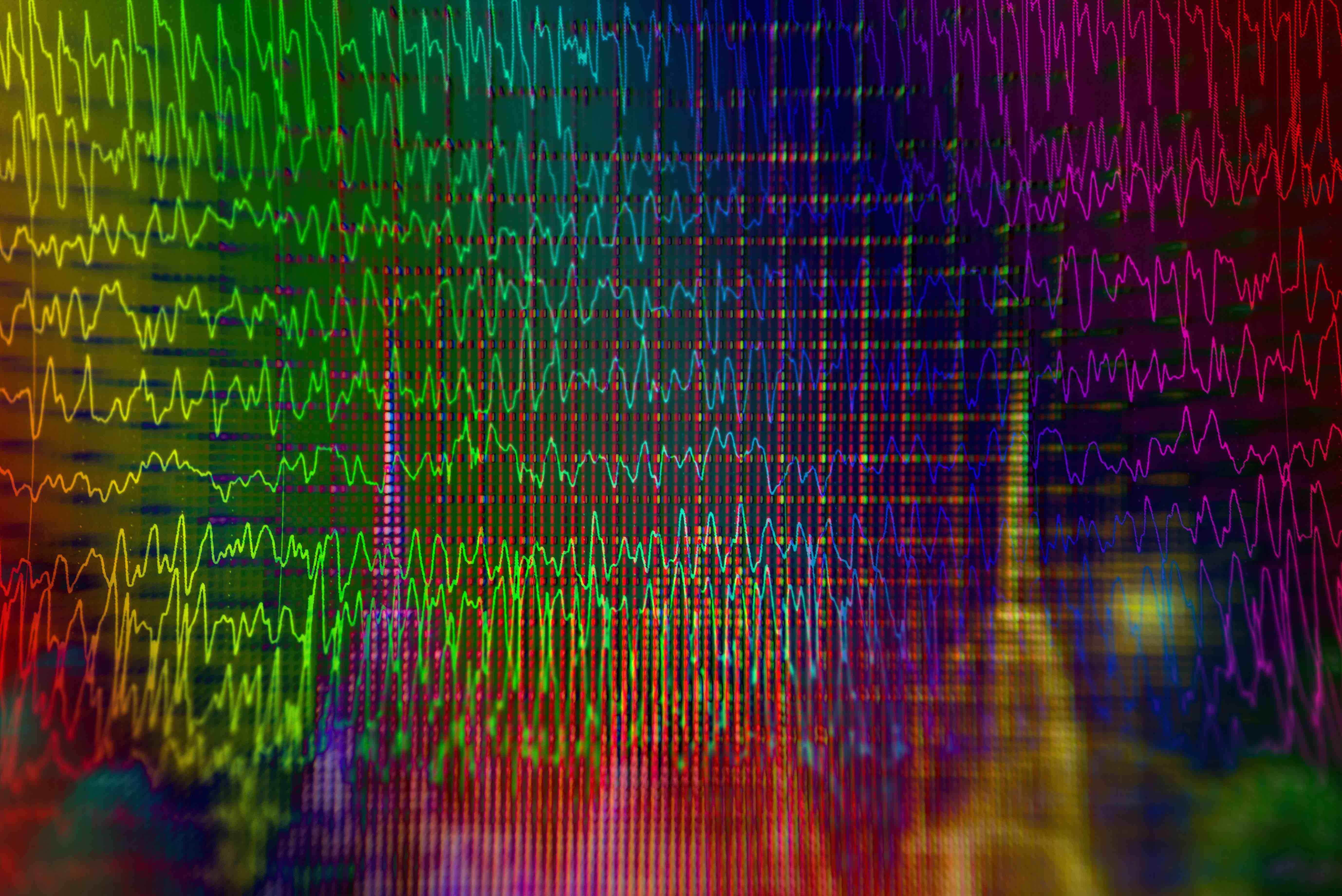 L’EEG haute densité pour l’étude de la cognition