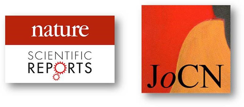 Nouvelles parutions au LPL dans les revues “Scientific Reports – Nature” et “Journal of Cognitive Neuroscience”