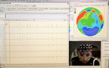 Challenges and new perspectives of developmental cognitive EEG studies